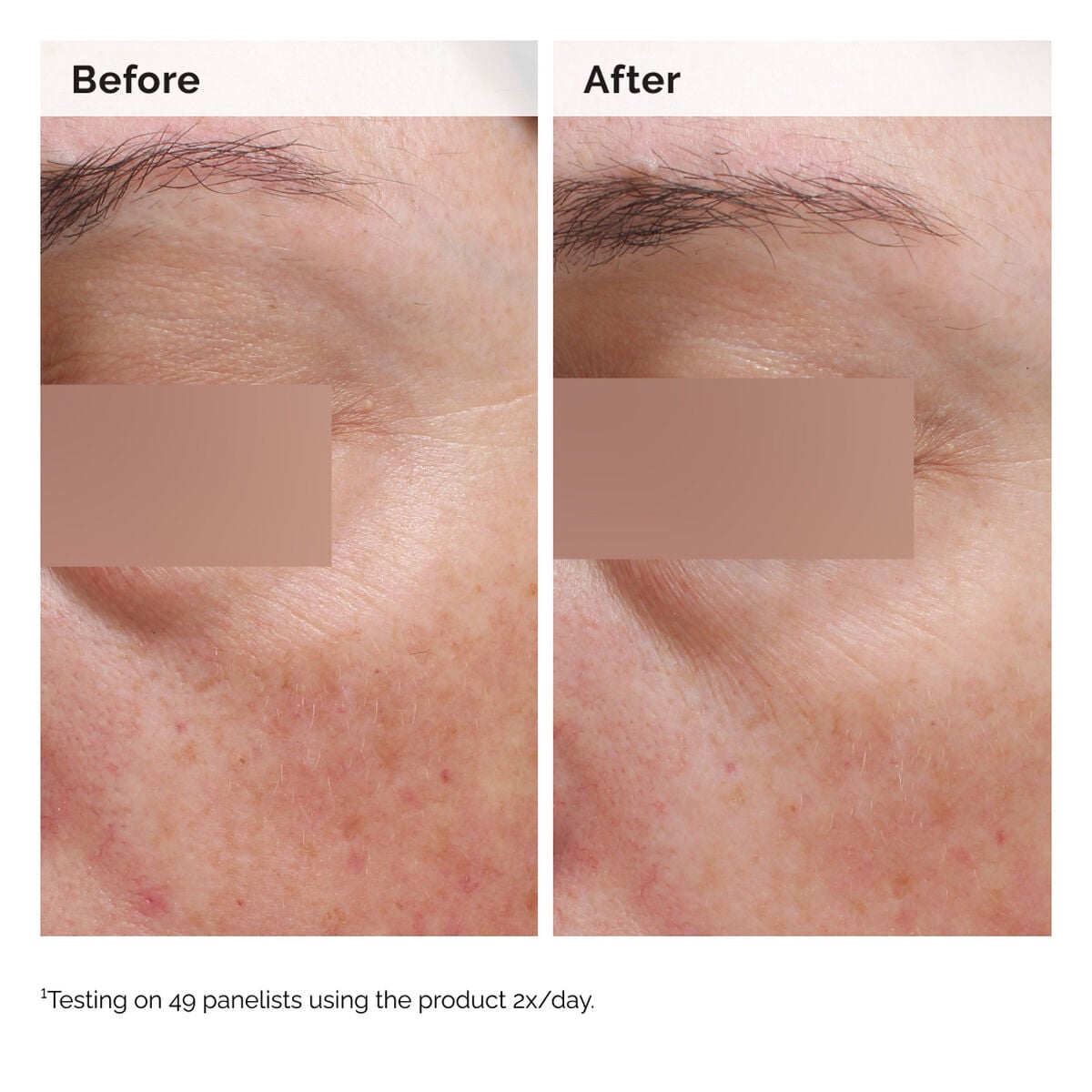 niacinamide-5-face-and-body-emulsion-m9 2024-08-23-ORD-Nia-5pct-Face-Body-B-A-Elasticity-Global-02-1x1.jpg