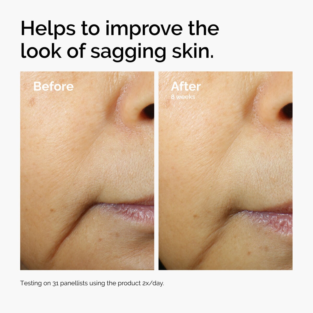 caffeine-3-escin-1-face-serum-n4 ord-caffeine-3pct-escin-1pct-face-serum-before-after-sagging.jpg