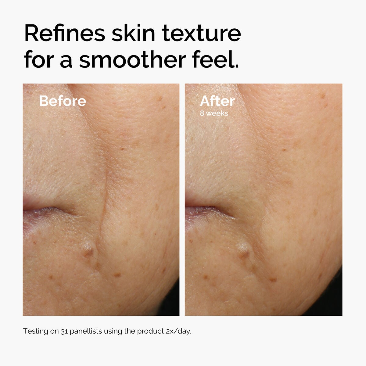 caffeine-3-escin-1-face-serum-n4 ord-caffeine-3pct-escin-1pct-face-serum-before-after-texture.jpg