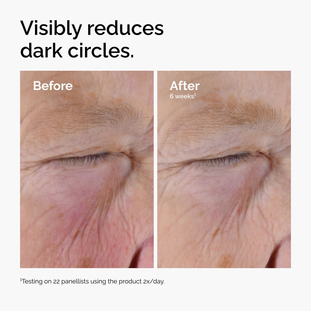 caffeine-solution-5-egcg-eye-serum-m9 ord-caffeine-solution-egcg-dark-circles-before-after.jpg