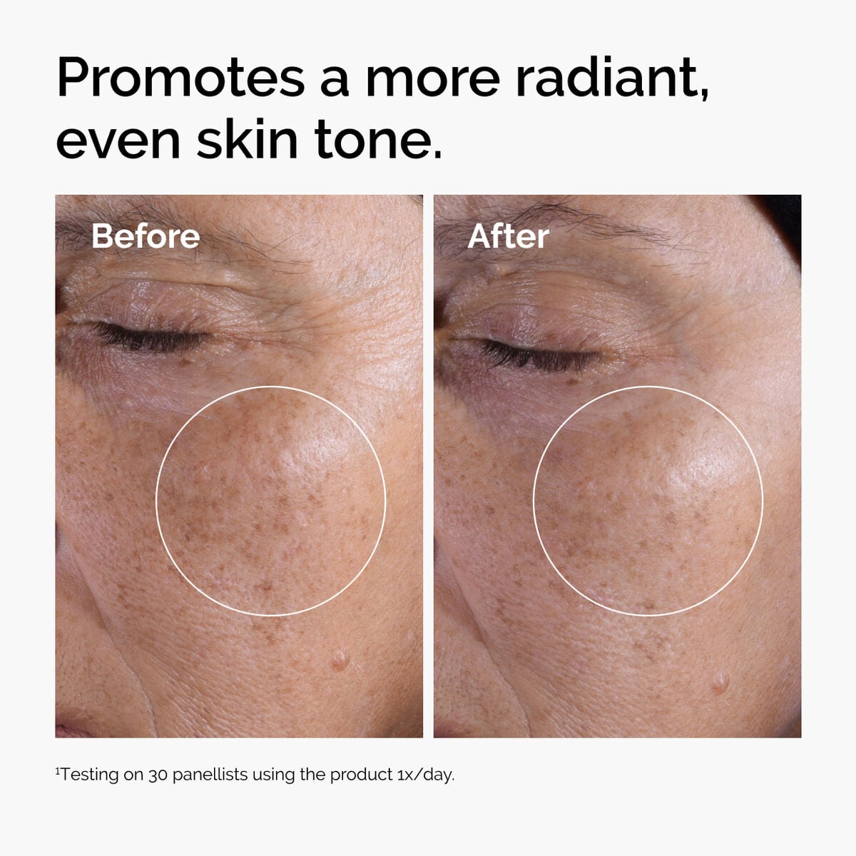 glycolic-acid-7-exfoliating-toner-b8 ord-glycolic-before-after-radiance.jpg