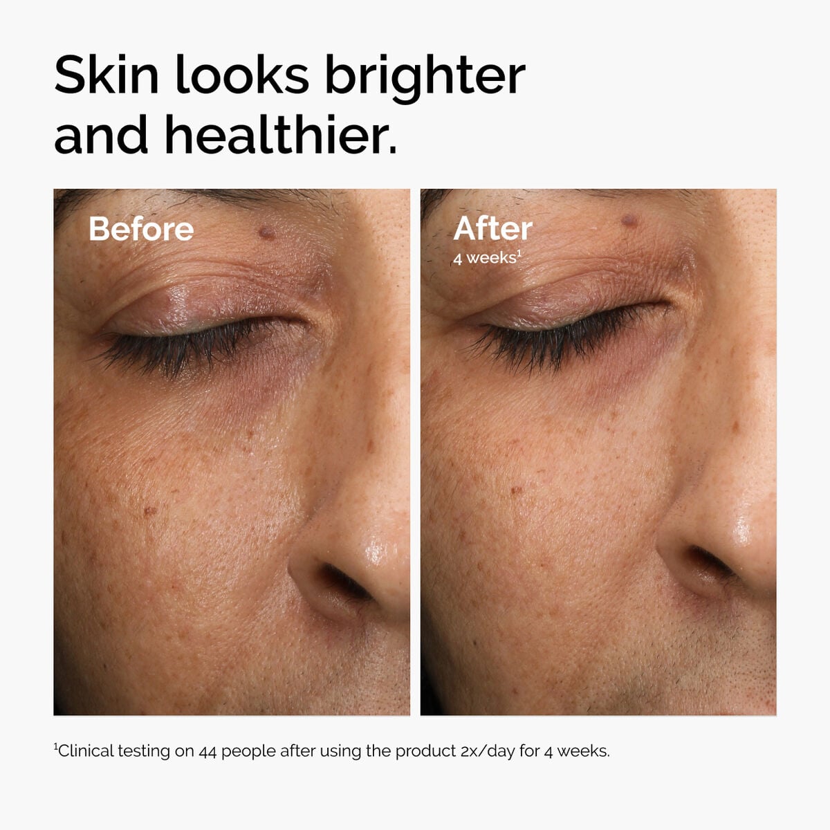 multi-antioxidant-radiance-serum-q5 ord-mars-before-after-healthy.jpg