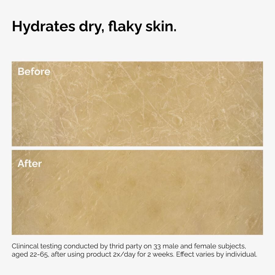 the-body-care-collection-k6 ord-natural-moisturizing-factors-inulin-body-before-after-graphic-02.jpg