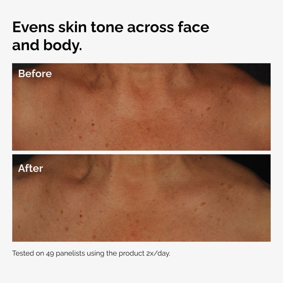 the-body-care-collection-k6 ord-niacinamide-face-body-serum-before-after-even-tone-graphic.jpg
