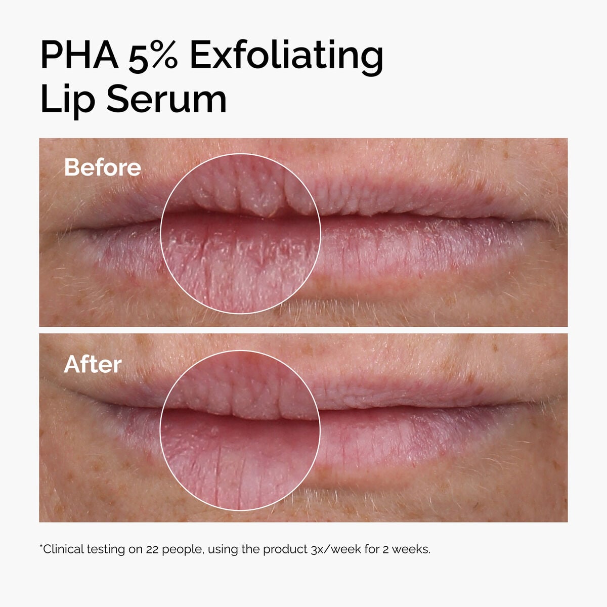 pha-5-exfoliating-lip-serum-n9 ord-pha-5pct-lip-exfoliating-serum-before-after.jpg